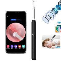 Wireless Smart Visual Ear Cleaner Otoscope NP20 Oorsmeer verwijderingsgereedschap met camera Oorenoscope 1080P kit voor