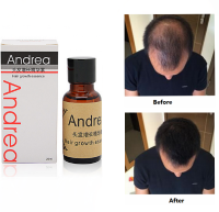 Fast Hair Growth Essence Liquid Pilatory For Men And Women 20ml