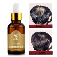 Hair Growth Essence Liquid Chinese Medicine Herbal 30ml