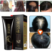 250Ml Hair Loss Care Shampoos Growth Natural Herb Effective Solution Hair Thinning Breakage