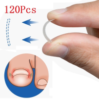 Ingrown Toenail Straightening Clip Curved Bs Brace Toenails Thick Paronychia Correction Tool About 120pcs