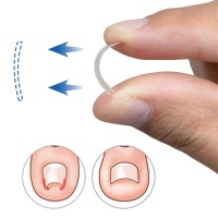 Toenail Straightening Clip Paronychia Correction Tool Nail Bonding Glue Remover Bond Gel Glue Liquid