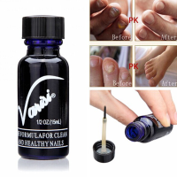 Varisi Toe Finger Healthy Nail Fungus Cure Antifungal Fungal Lotion